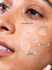 Blemish Patch Discovery Kit