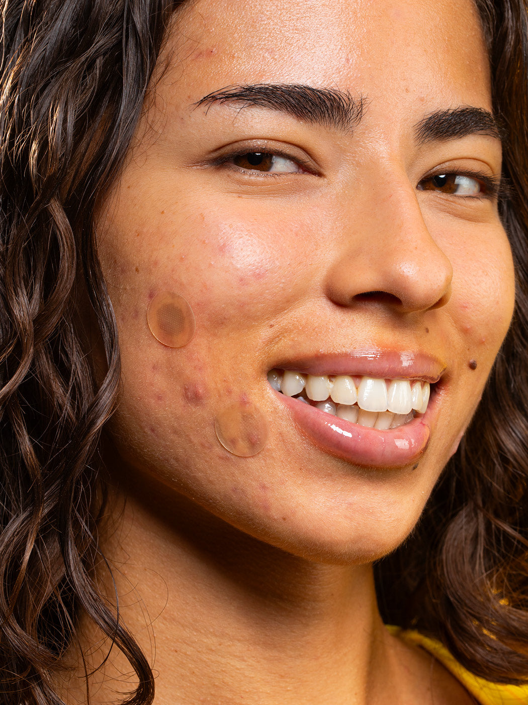 Brightening Microdart Patch