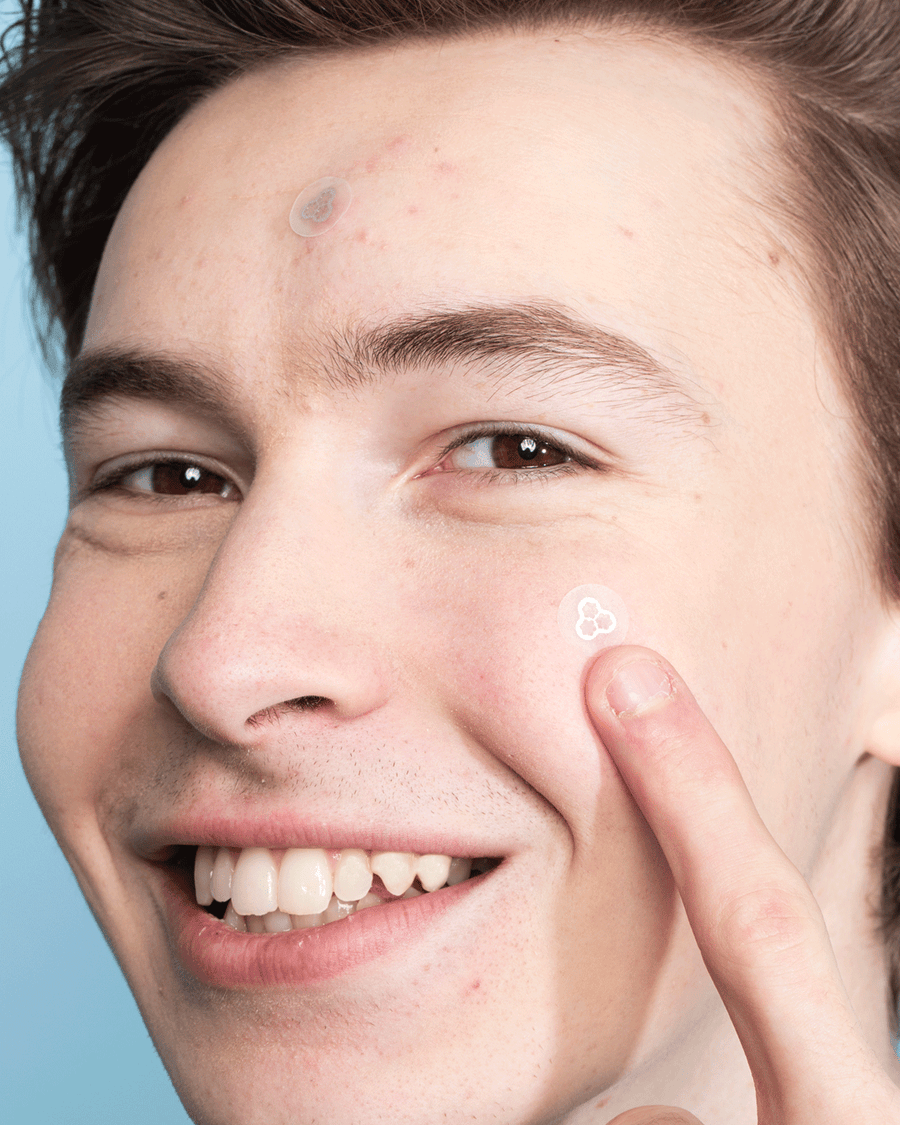 EraZit Magnesium Microneedle Patch